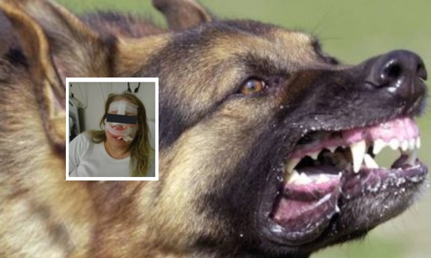 Cane aggredisce donna, morsi al volto e ad un braccio: paura in Campania