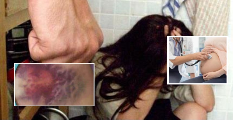 Napoli, massacra di botte la moglie incinta e uccide il bambino