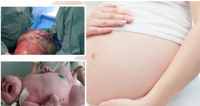 Salerno, asportano tumore a donna incinta: il bambino è nato sano