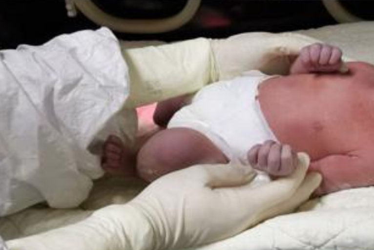 Coronavirus, positivo bimbo di 5 mesi: scatta il ricovero in ospedale