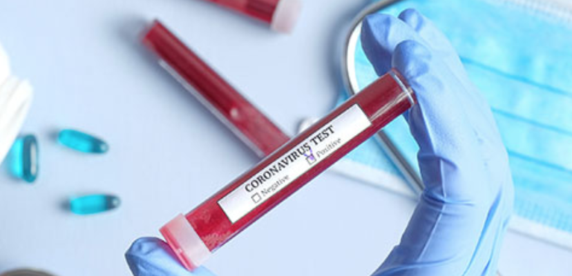 Coronavirus, il nuovo bollettino: i positivi della regione sono 1952