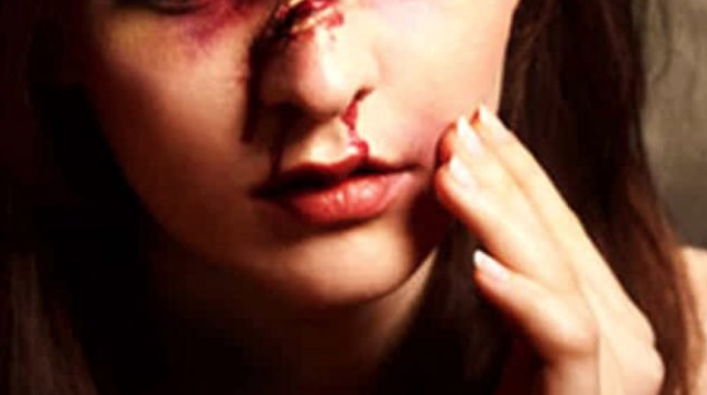 Napoli, calci e pugni alla fidanzata: la donna ferita e mandata all'ospedale