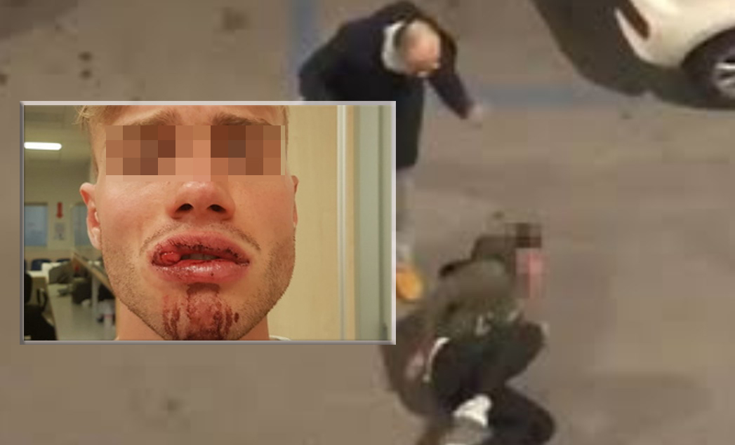 Violenza a Roma, giovane di 23 anni aggredito da due agenti in borghese: "Minacciato e picchiato"