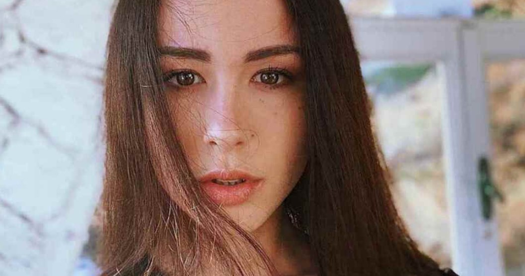 Aurora Ramazzotti dopo la foto con le imperfezioni confessa: "E' stato un vaffa"