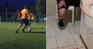 Giovane pestato dopo una partita di calcio a Casoria