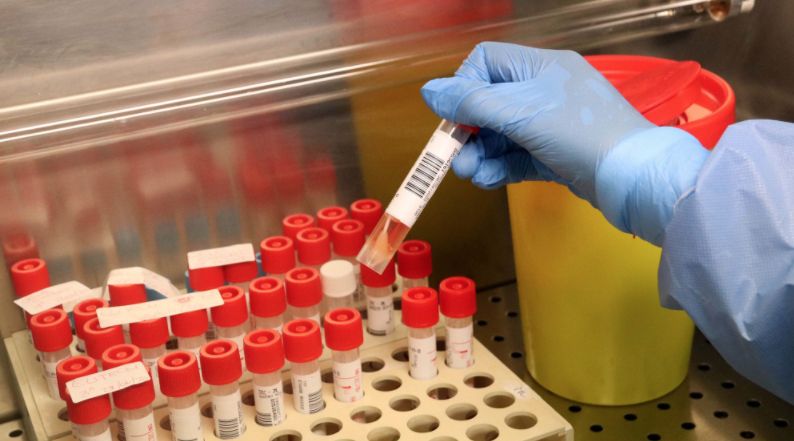 Coronavirus, il bollettino: in Italia 27.354 nuovi casi nelle ultime 24 ore