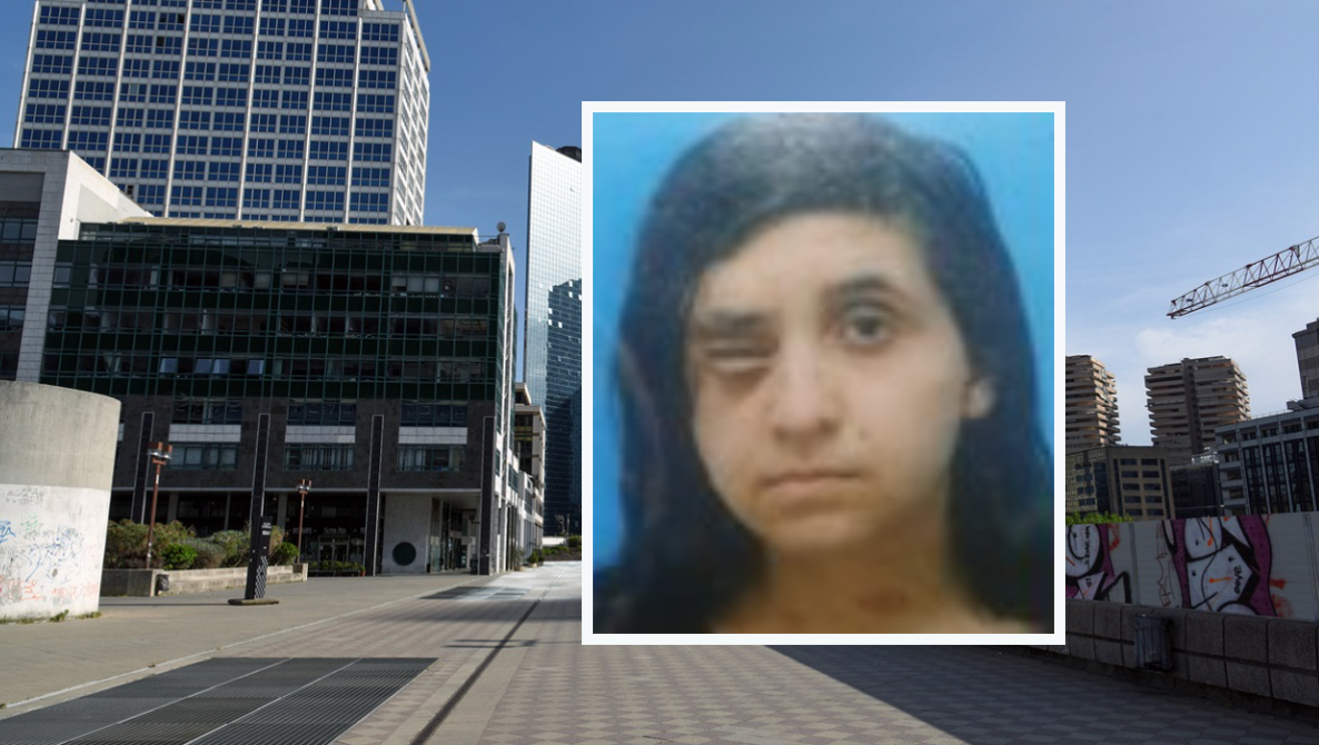 Non trova lavoro perchè sfigurata dalla malattia, l'appello di Giovanna: "Datemi una possibilità"