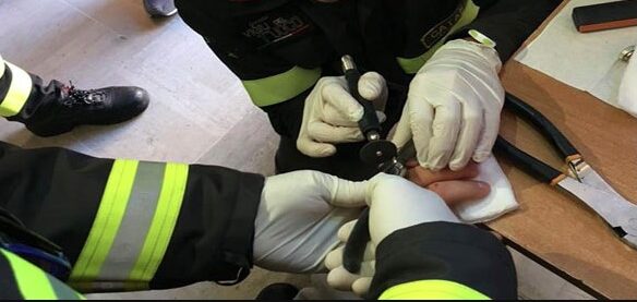 Paura a Caserta, la fede nuziale s'incastra e intervengono i vigili del fuoco