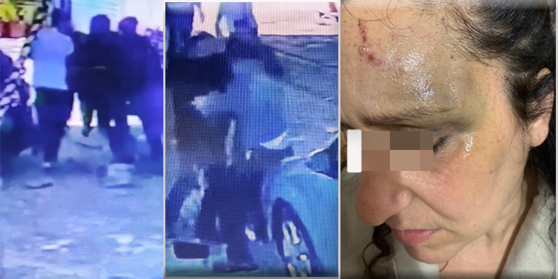 Lite in strada degenera a Castel Volturno, donna malmenata da un uomo: "Hanno picchiato anche mio figlio minore"