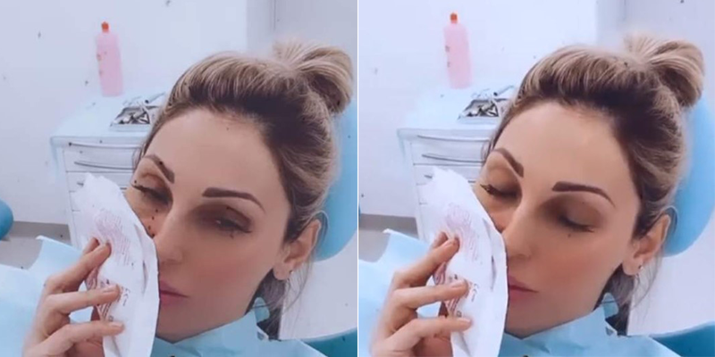 Cosa è successo ad Anna Tatangelo? La foto con il volto gonfio