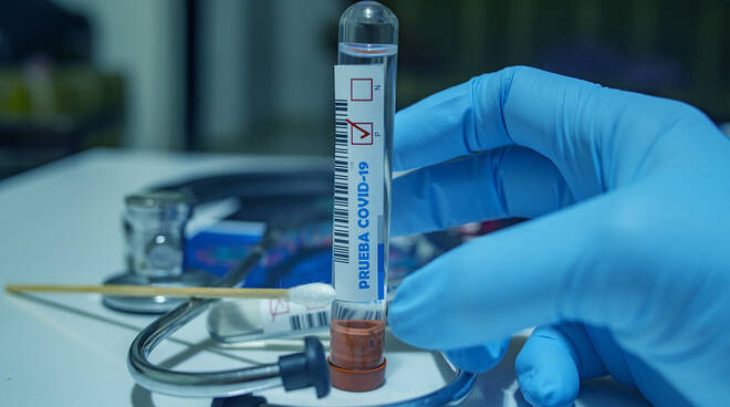 Coronavirus, gli esperti non hanno dubbi: “A Napoli e Milano necessario il lockdown”