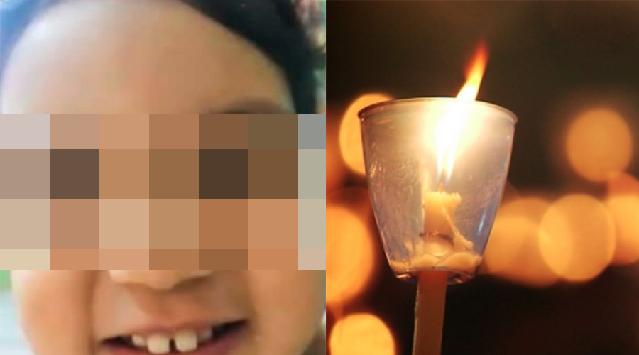 fiaccolata bambina santobono