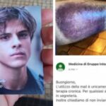 Michele Merlo, la foto dell'ematoma al medico