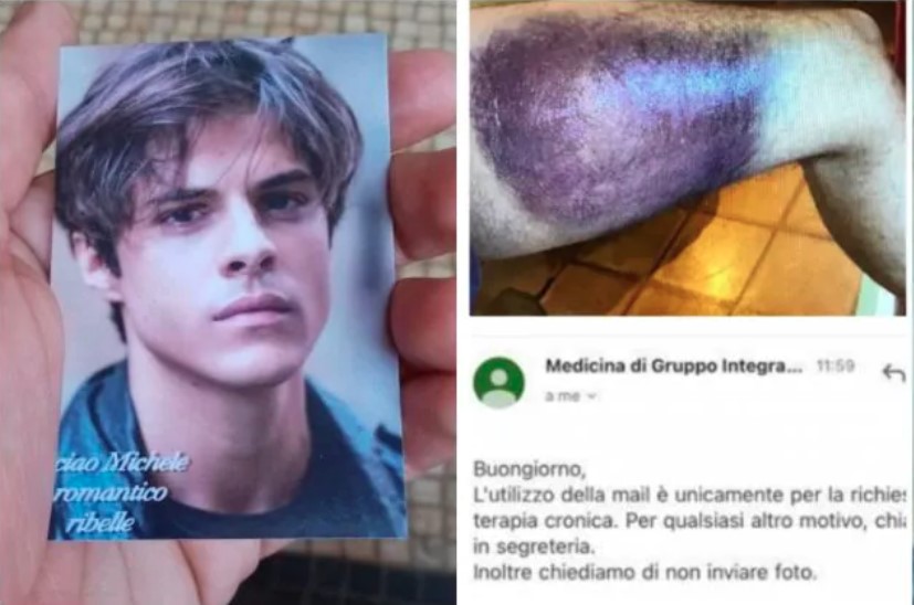 Michele Merlo, la foto dell'ematoma al medico